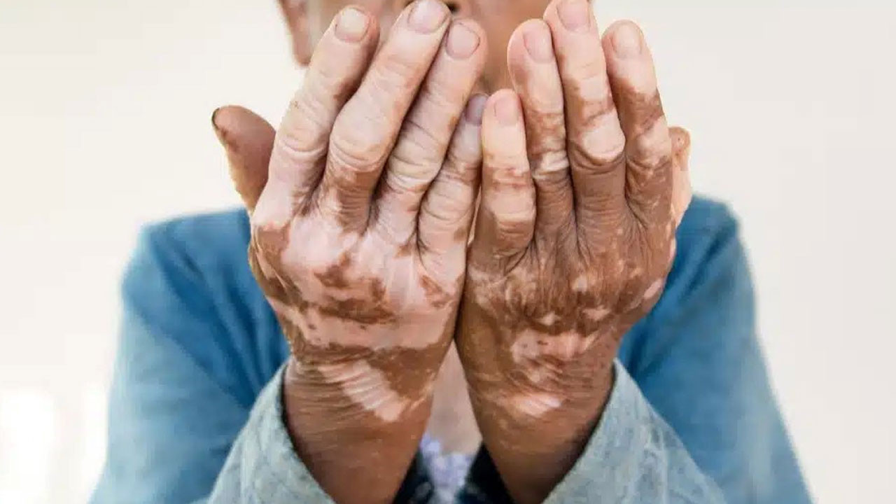 Vücudun sessiz çığlığı! Sinsi tehlikenin ilk işareti