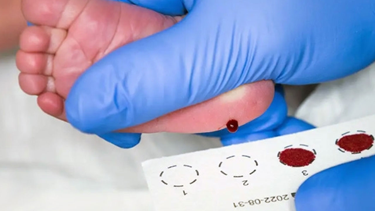 Çocukların yenidoğan dönemlerindeki topuk kanı taramasının önemi