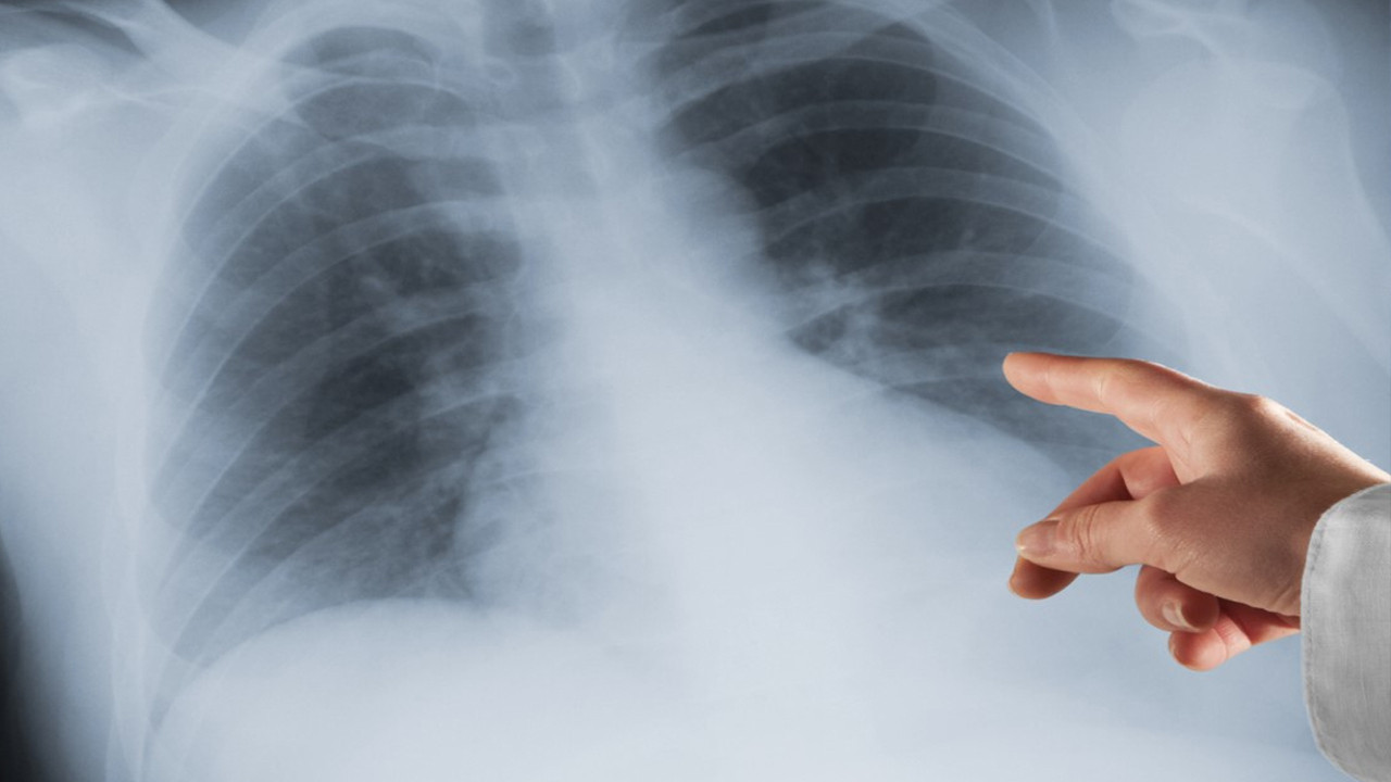 Beş dakikalık sır kansere duvar örüyor