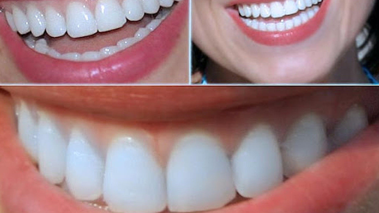 Gülüşlerin geleceği 30 dakikada belirleniyor! Uzmanlar sırrın perdesini araladı