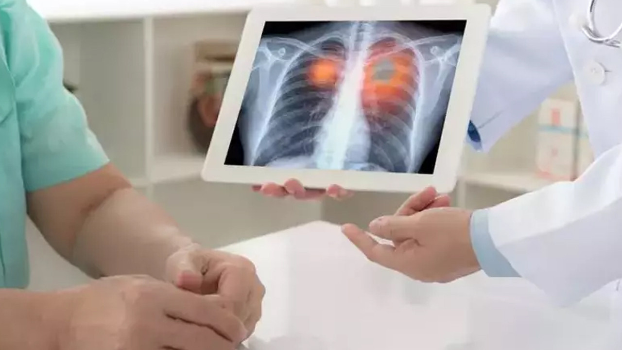 Hücrelerin sessiz katili! O alışkanlık, akciğer kanserini 20 kat hızlandırdı