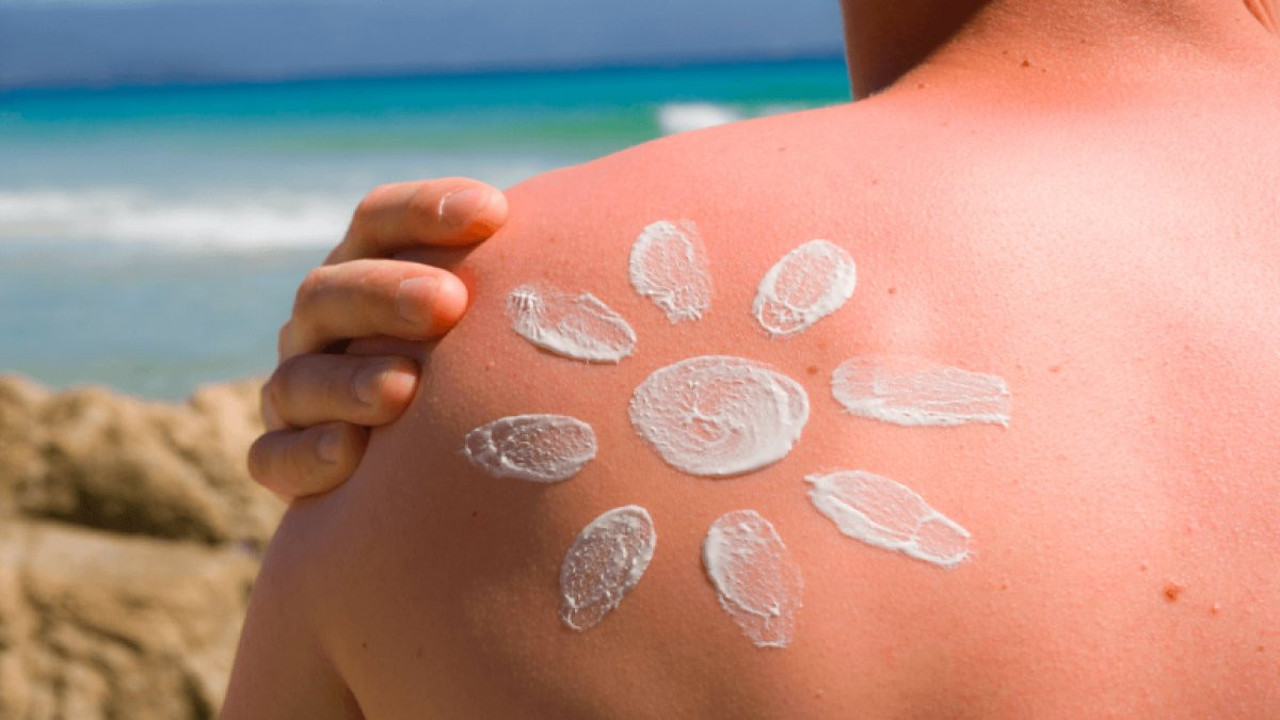 Güneş yanığı belirtileri neler? Güneş yanığına ne iyi gelir?