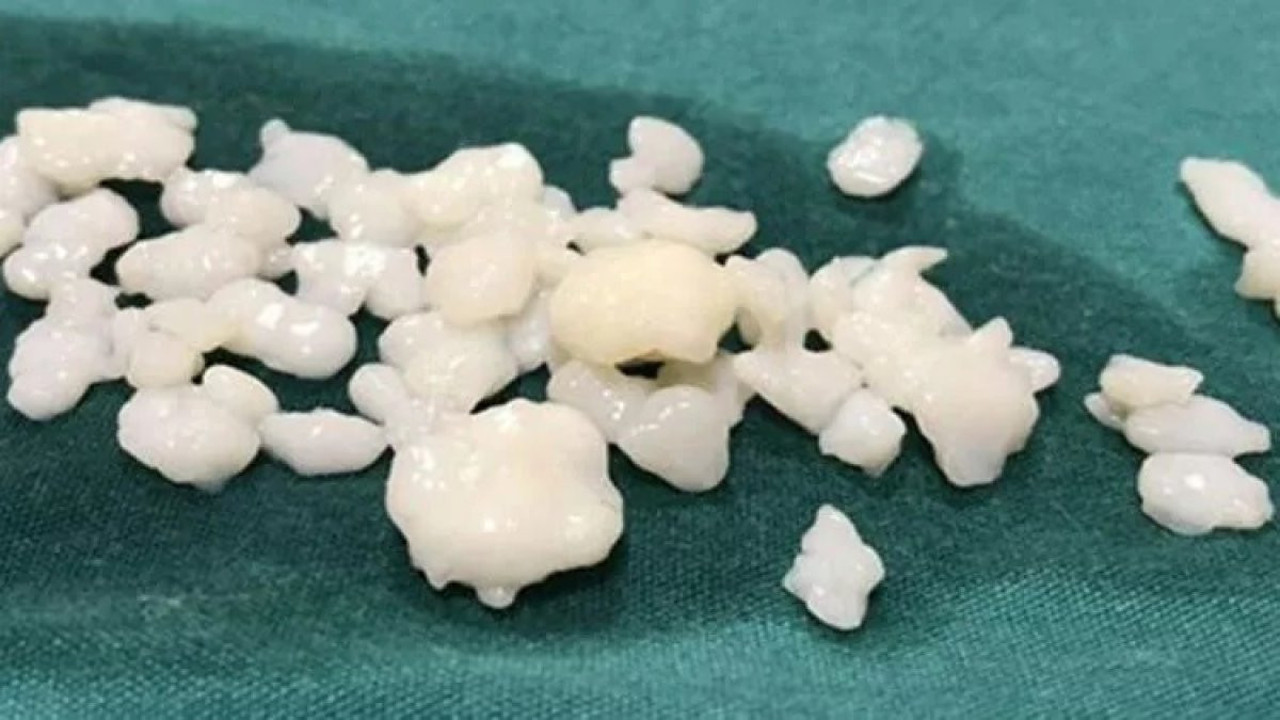 Minicikler çok can acıtıyorlar