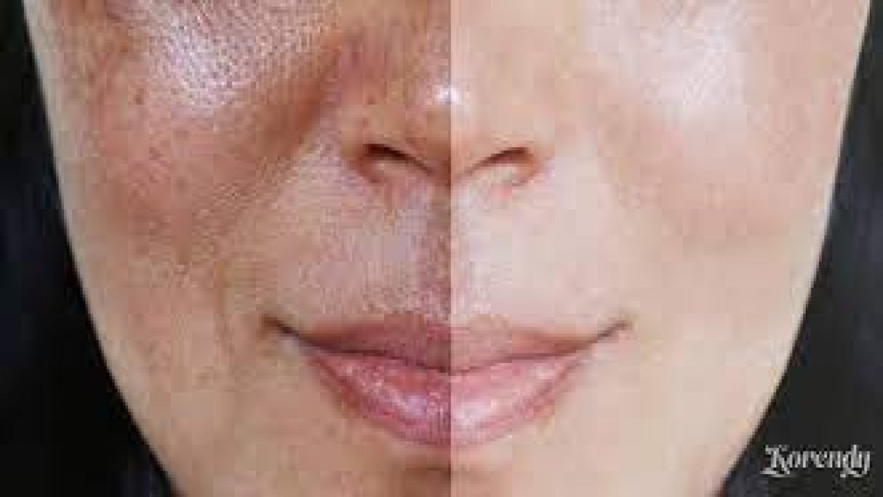 Cild kuruması beraberinde başka sorunlar yaratır