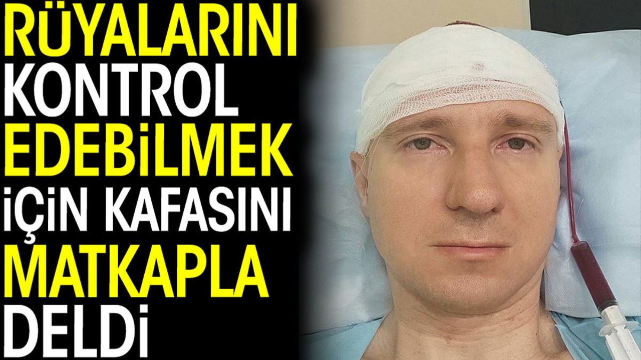 Rüyalarını kontrol edebilmek için kafasını matkapla deldi