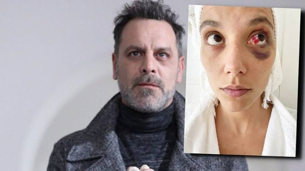 Ozan Güven'in şiddet uyguladığı Deniz Bulutsuz'un adli tıp raporu ortaya çıktı