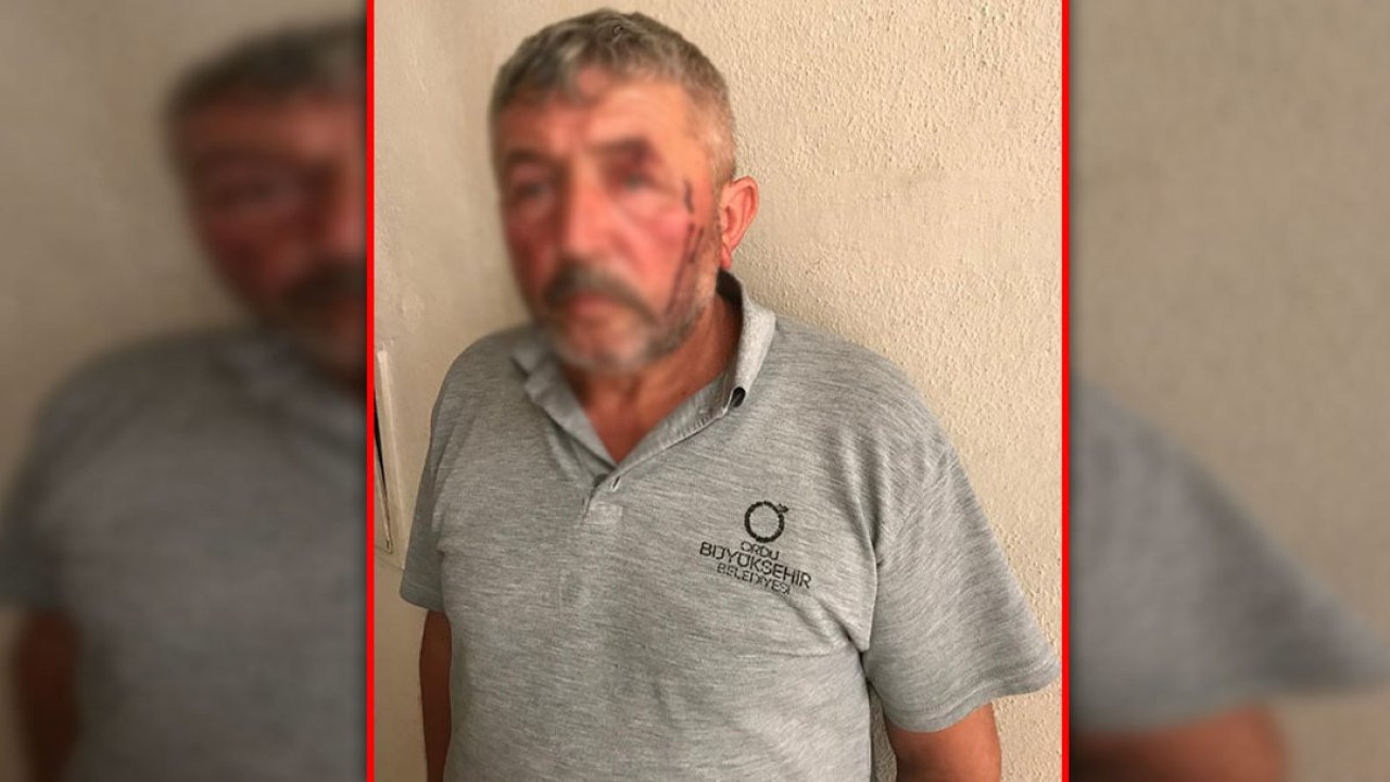 Belediye işçisi daire başkanı tarafından makam odasında darp edildi