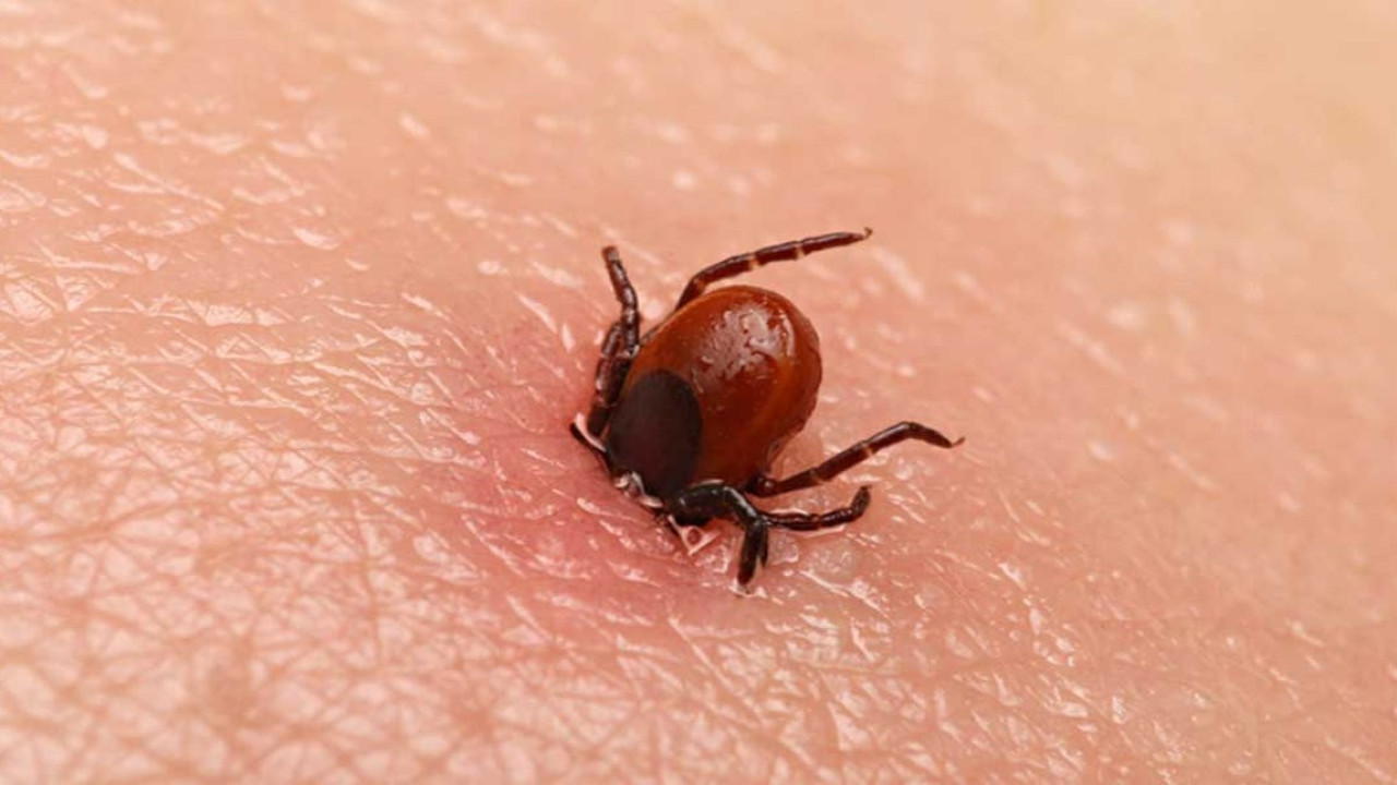 Vücuduna yapışan keneyi çıkardı. Canından oldu