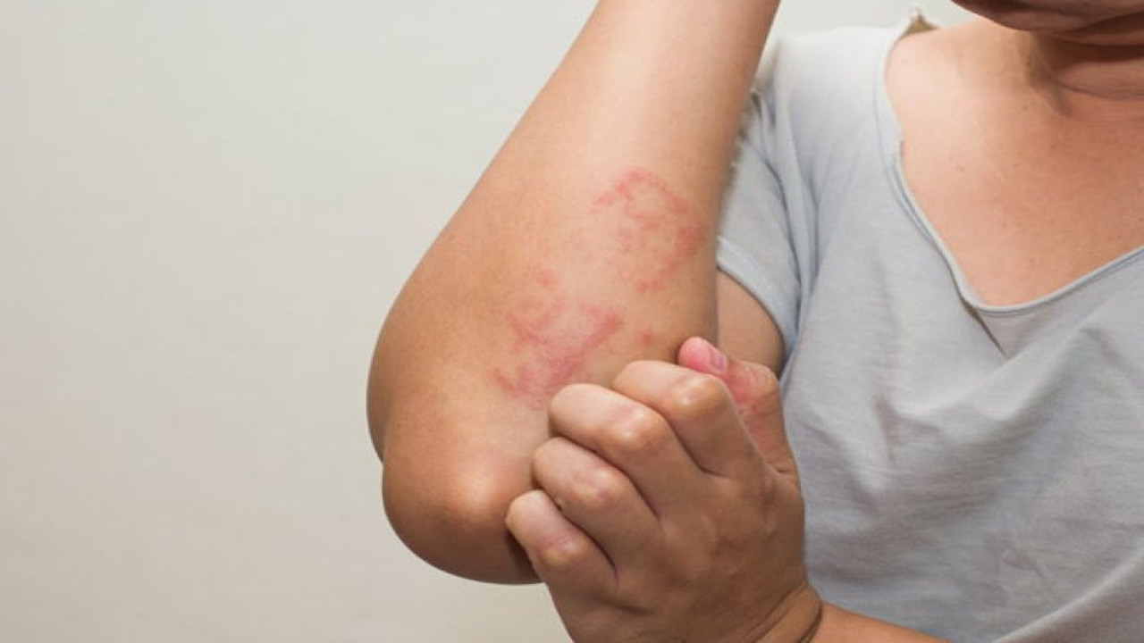 Cilt kanseri uyarısı. Bu saatlerde sakın dışarı çıkmayın