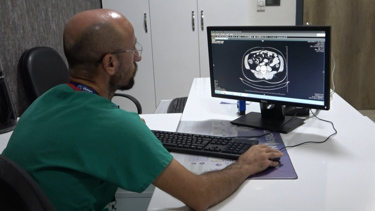 Uzmanlardan vatandaşlara kritik kolon kanseri uyarısı