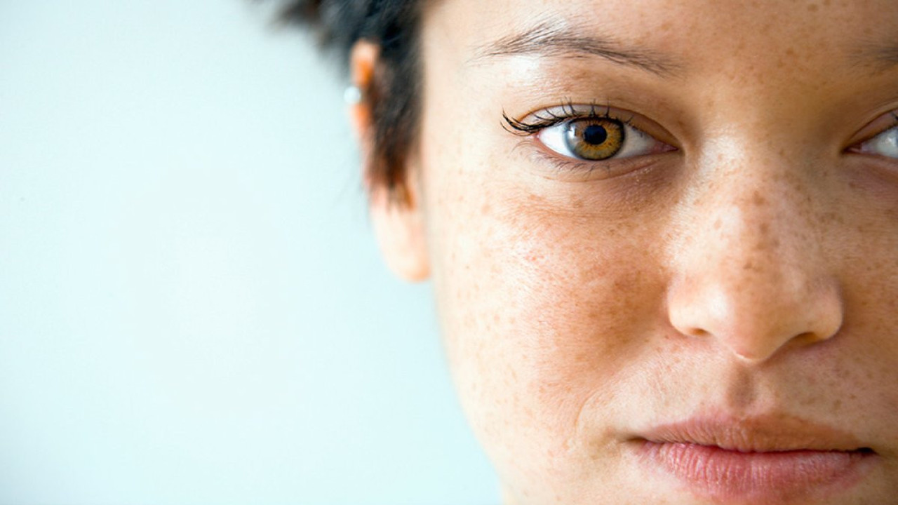 Hamilelik lekelerine doğal çözümler ortaya çıktı