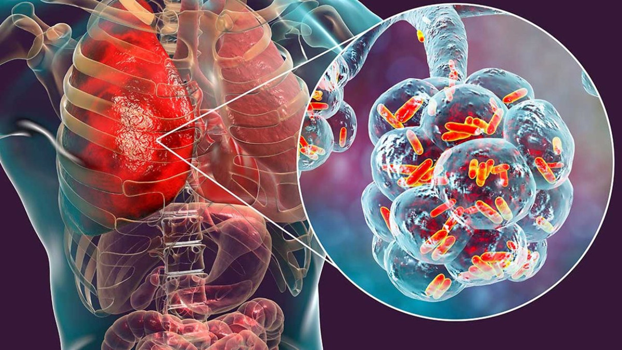 Polonya'da lejyonella bakterisi alarmı. 7 kişi öldü