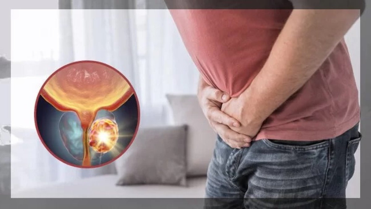 Prostat kanserinde hayat kurtaran 4 öneri