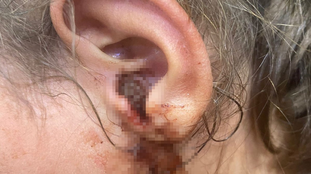 Çocuğun kulağından çıkanlar doktoru şok etti