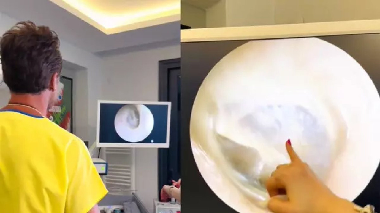 Eşini öperken kulağının zarını patlattı. Sevginin de çoğu zarar