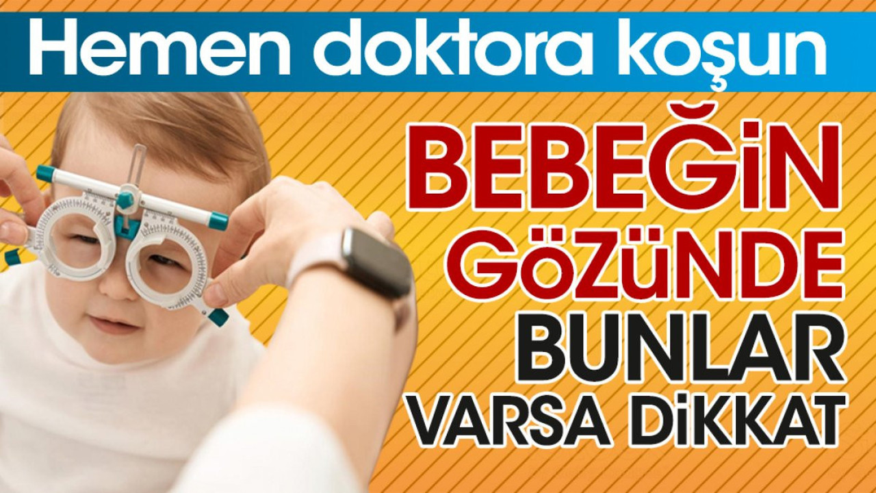 Bebeğin gözünde bunlar varsa dikkat. Hemen doktora koşun