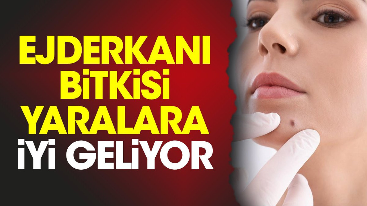 Yaralara iyi gelen bitki (05 Ekim 2023)