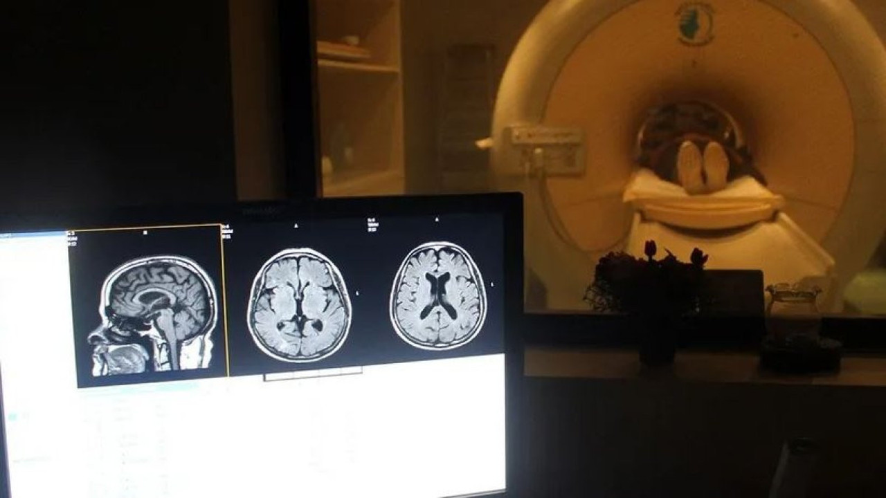 80 yıl boyunca beynindeki iğneyle yaşamış. Doktorlar şaştı kaldı