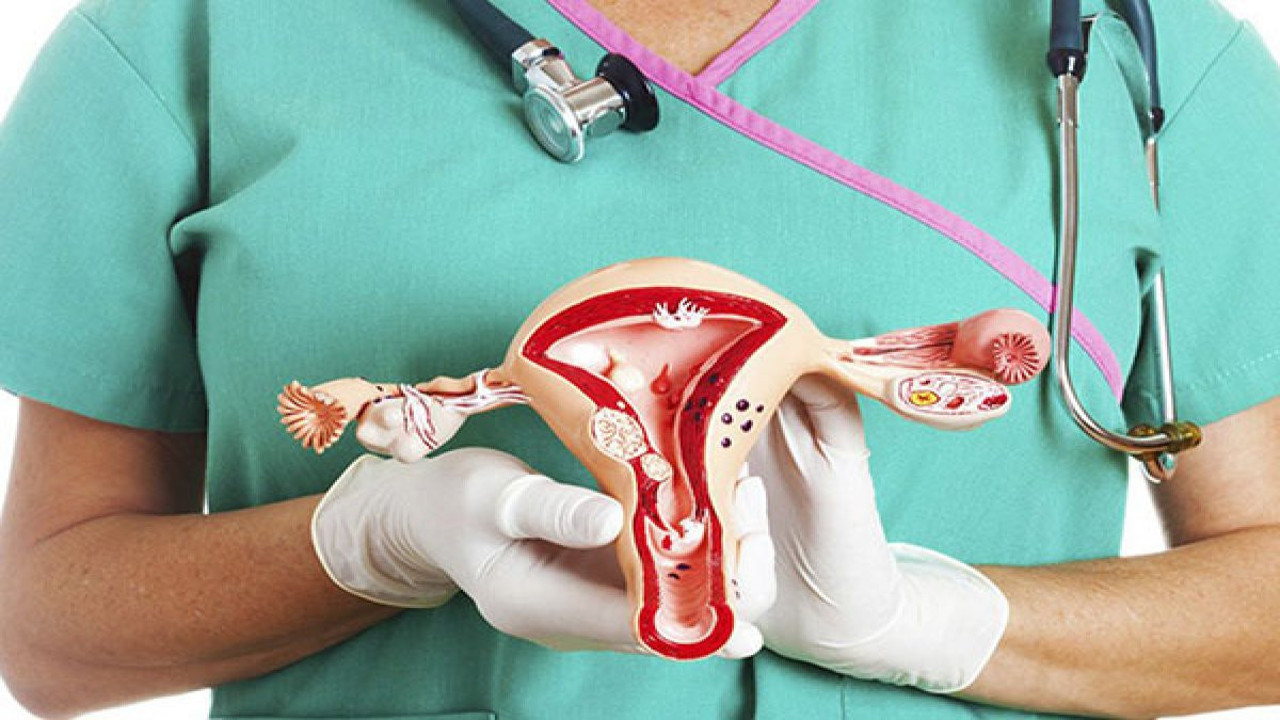 Polikistik Over nasıl tedavi edilir