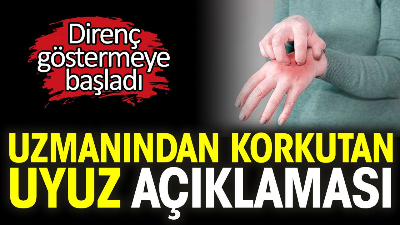 Uzmanından korkutan uyuz açıklaması. Direnç göstermeye başladı