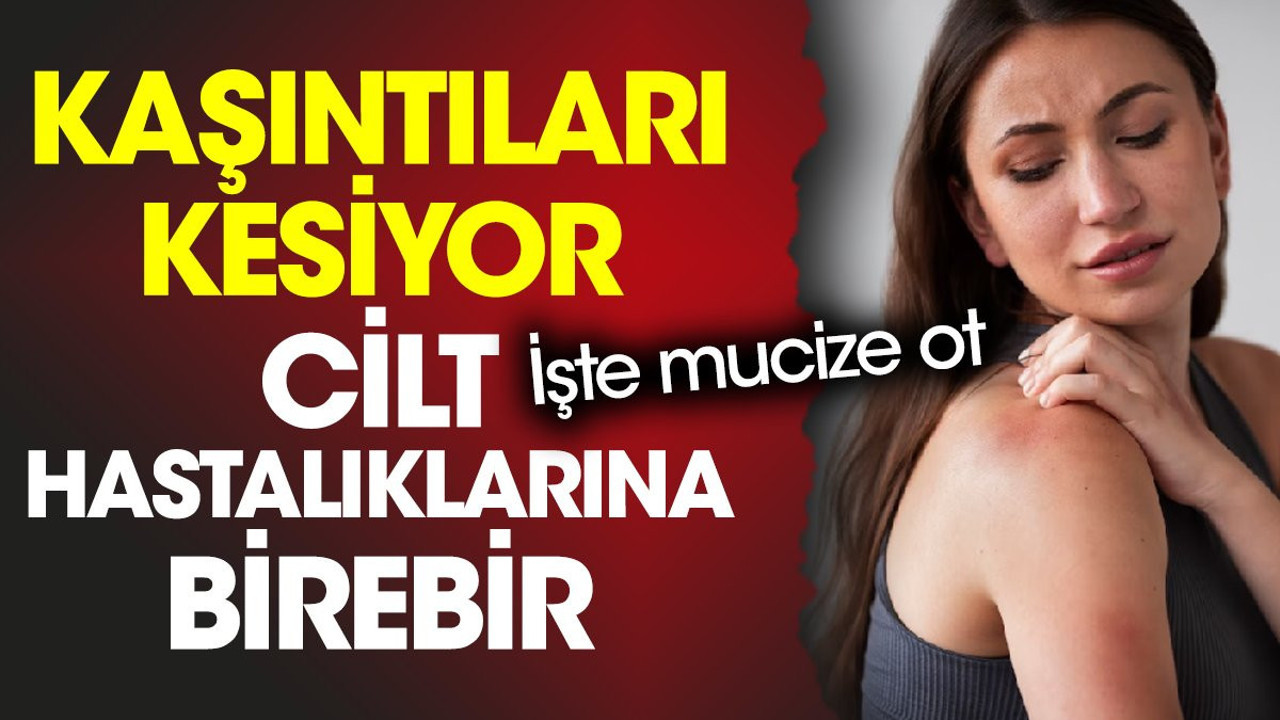 Kaşıntıları kesiyor. Cilt hastalıklarına birebir. İşte mucize ot