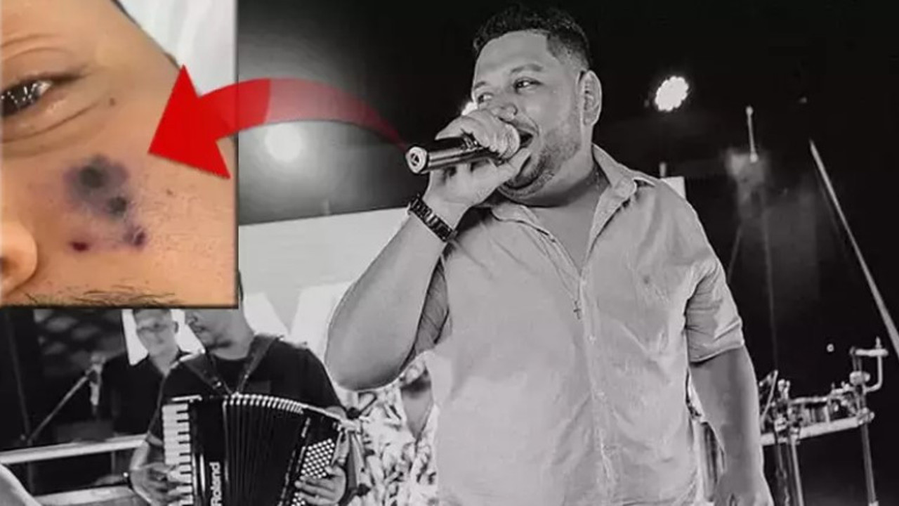 Örümcek ısırığı sonu oldu. Ünlü müzisyenin hayranları ve sevenleri şoke oldu