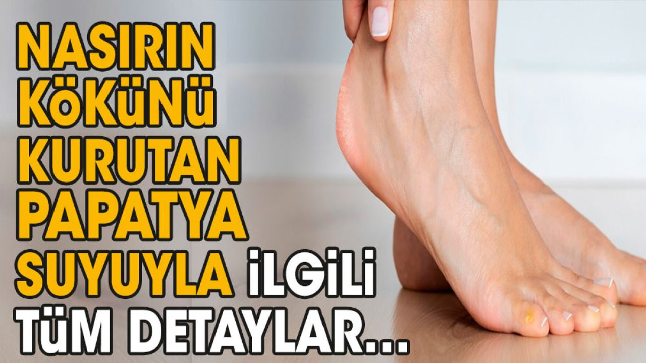 Nasırın kökünü kurutan papatya suyuyla ilgili tüm detaylar…