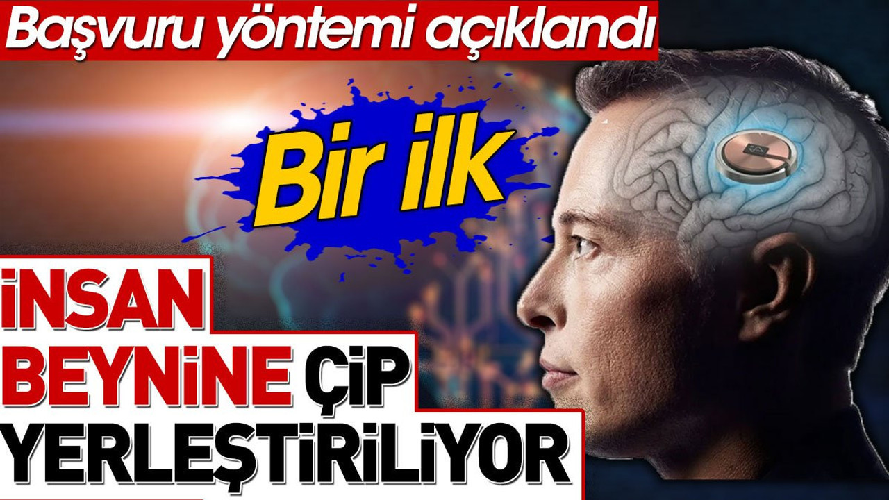 Bir ilk. İnsan beynine çip yerleştiriliyor. Başvuru yöntemi açıklandı