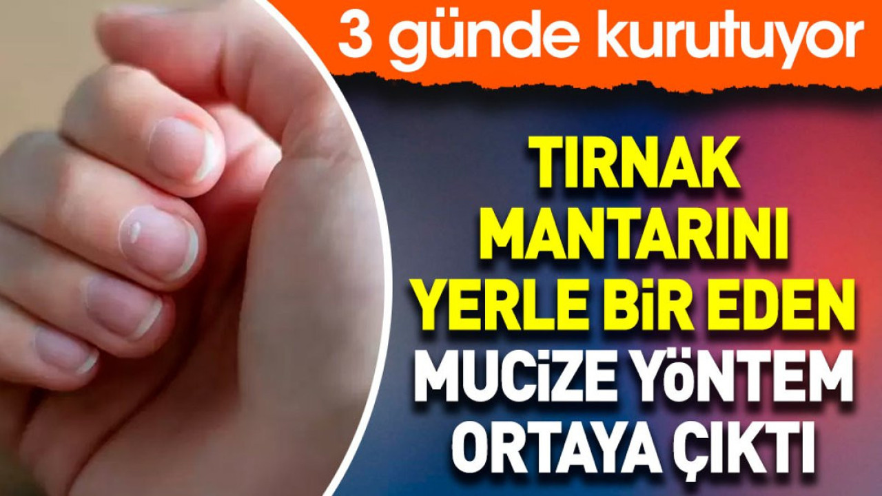 Tırnak mantarını yerle bir eden mucize yöntem ortaya çıktı. 3 günde kurutuyor