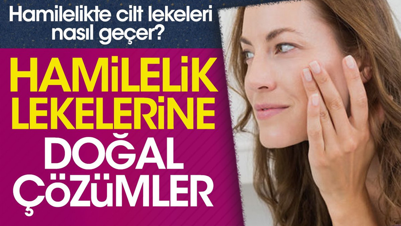 Hamilelikte cilt lekeleri nasıl geçer? Hamilelik lekelerine doğal çözümler