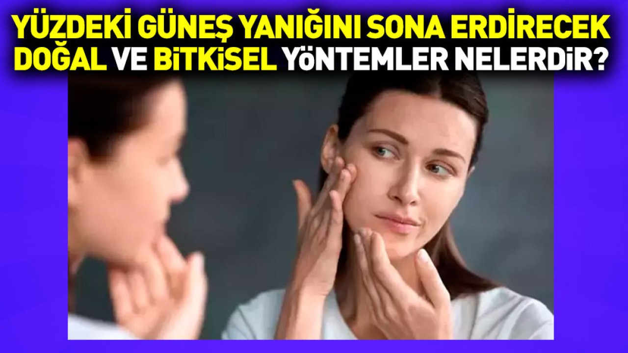 Yüzdeki güneş yanığını sona erdirecek doğal ve bitkisel yöntemler nelerdir?