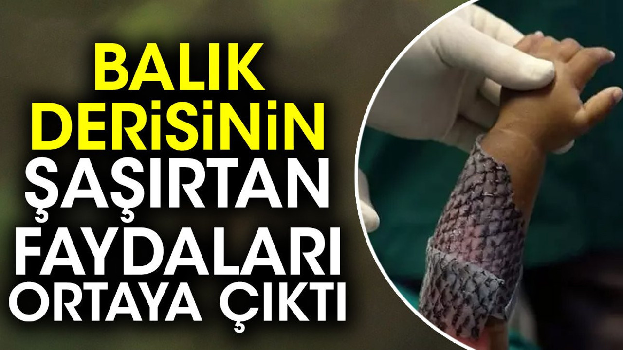 Balık derisinin şaşırtan faydaları ortaya çıktı