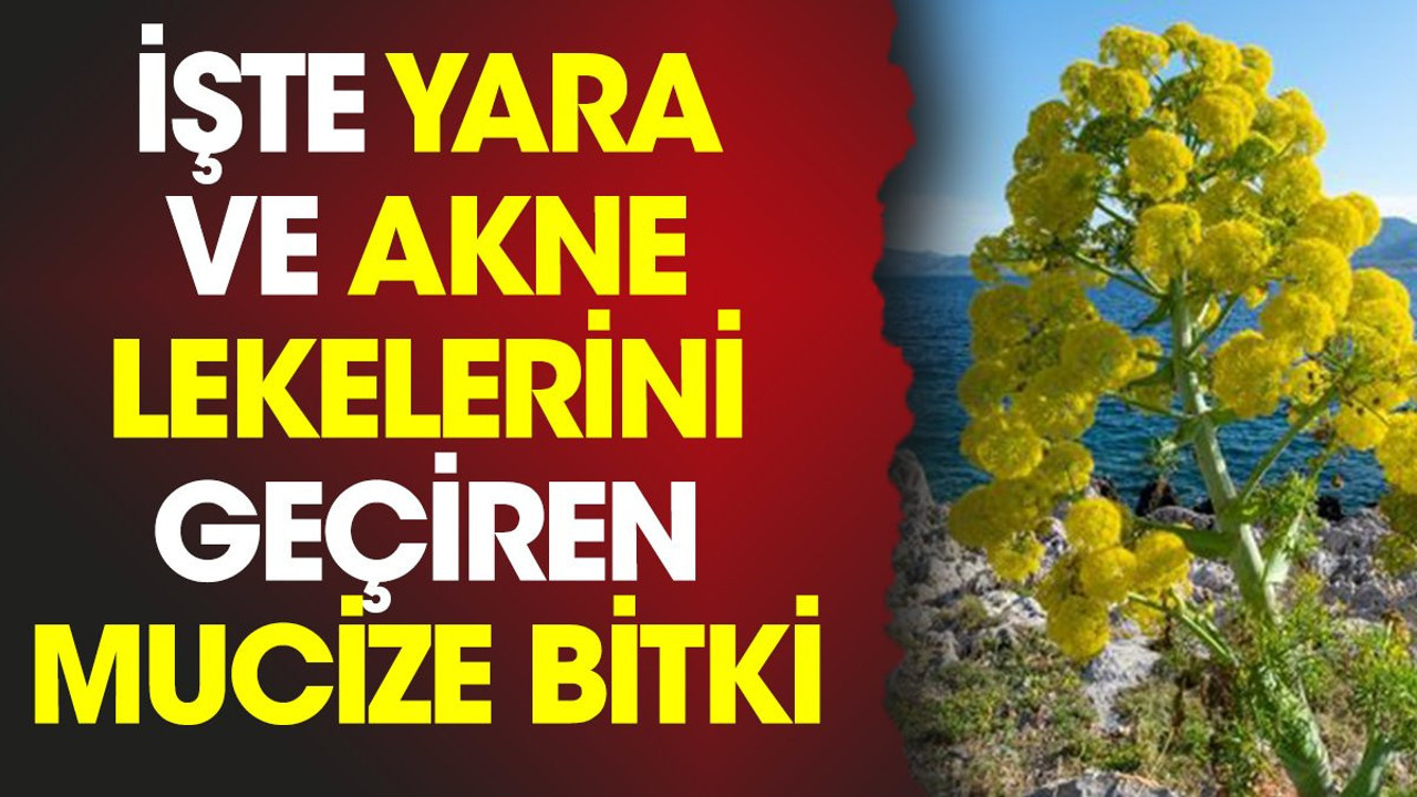 İşte yara ve akne lekelerini geçiren mucize bitki