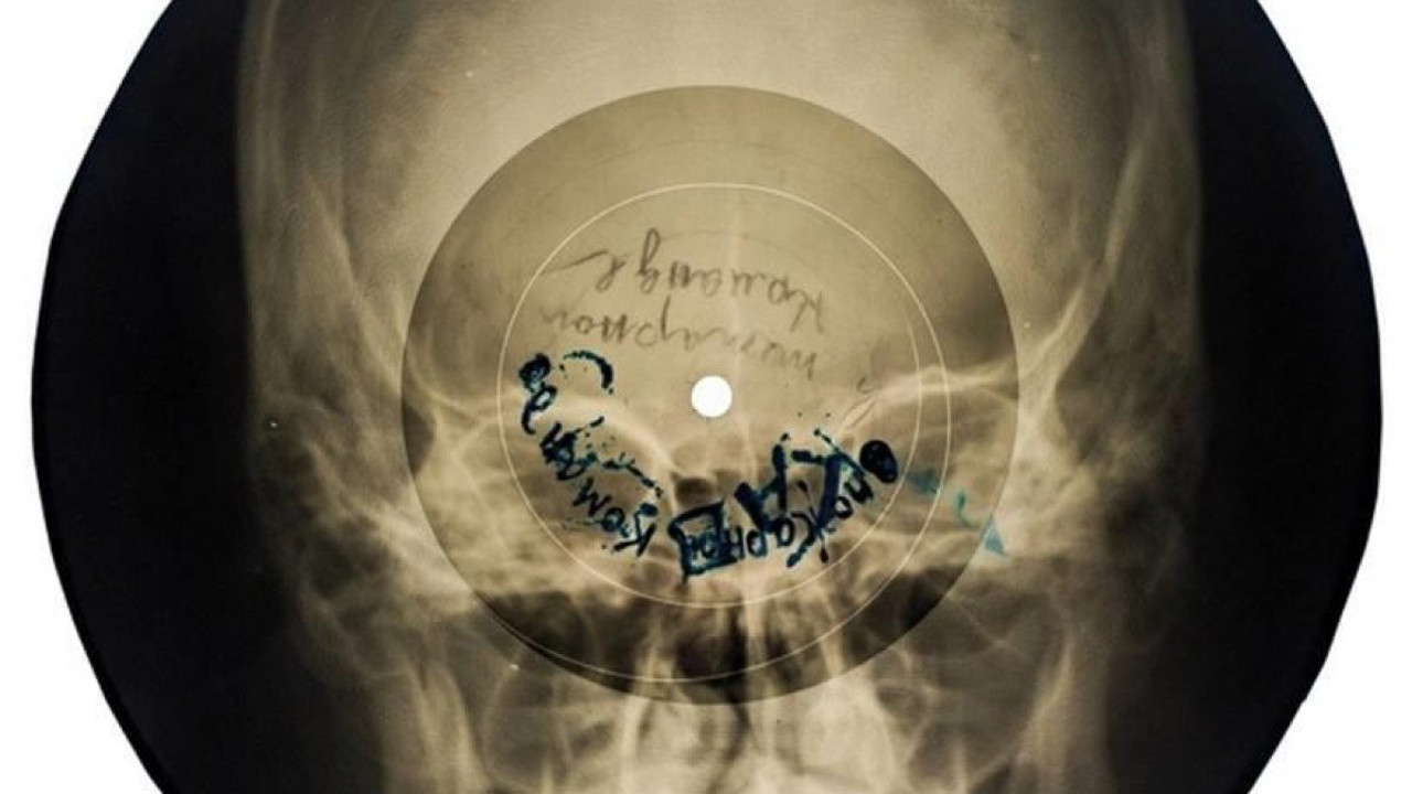 Sovyet Rusya’da yasaklı müzikleri röntgene basıp yaydılar. Rock ve jazz dinlemek yasaktı