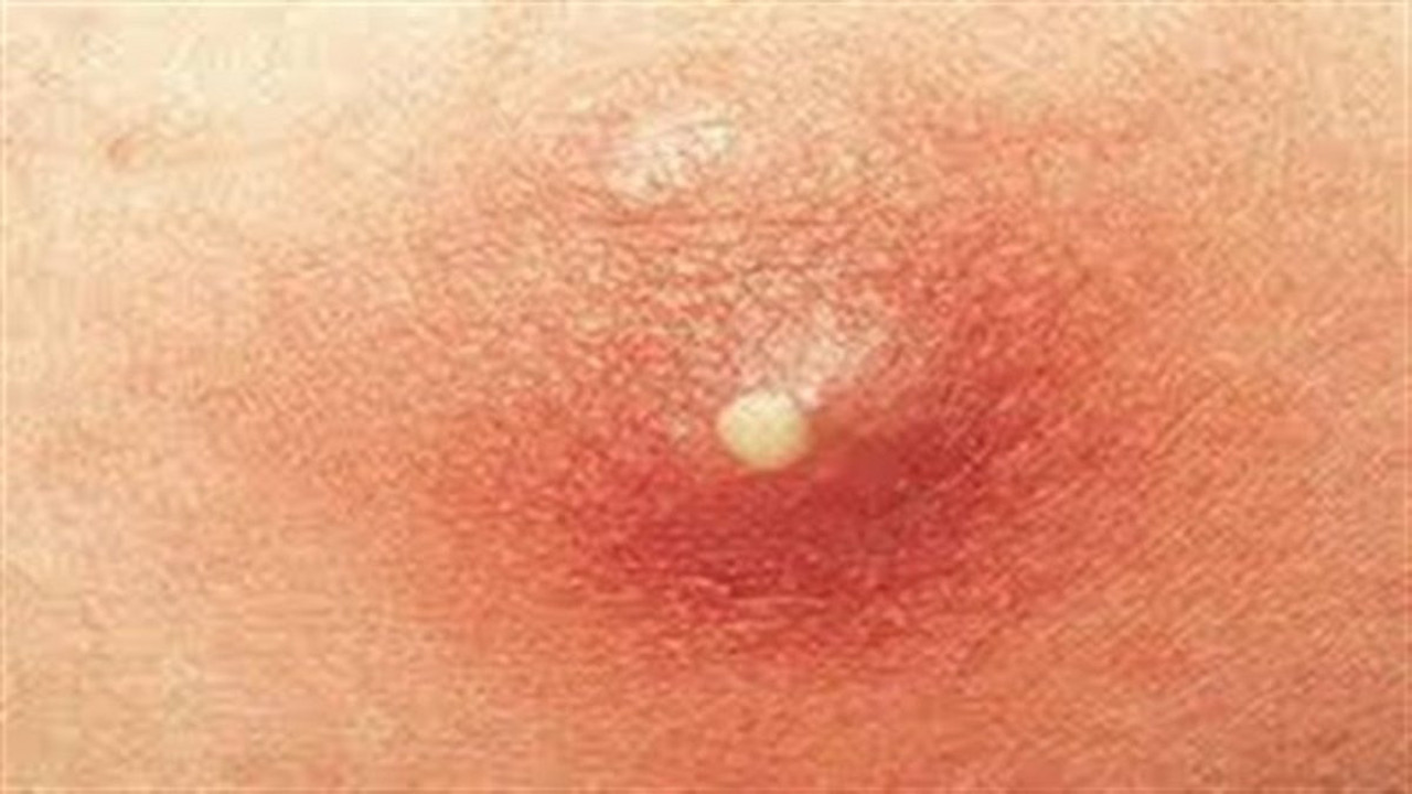 Sıkmayın öldürebilir