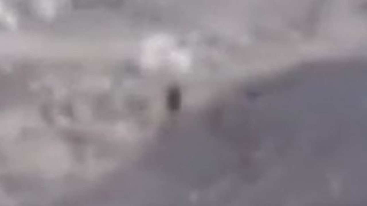 Ankara'da çocuğa domuz saldırdı