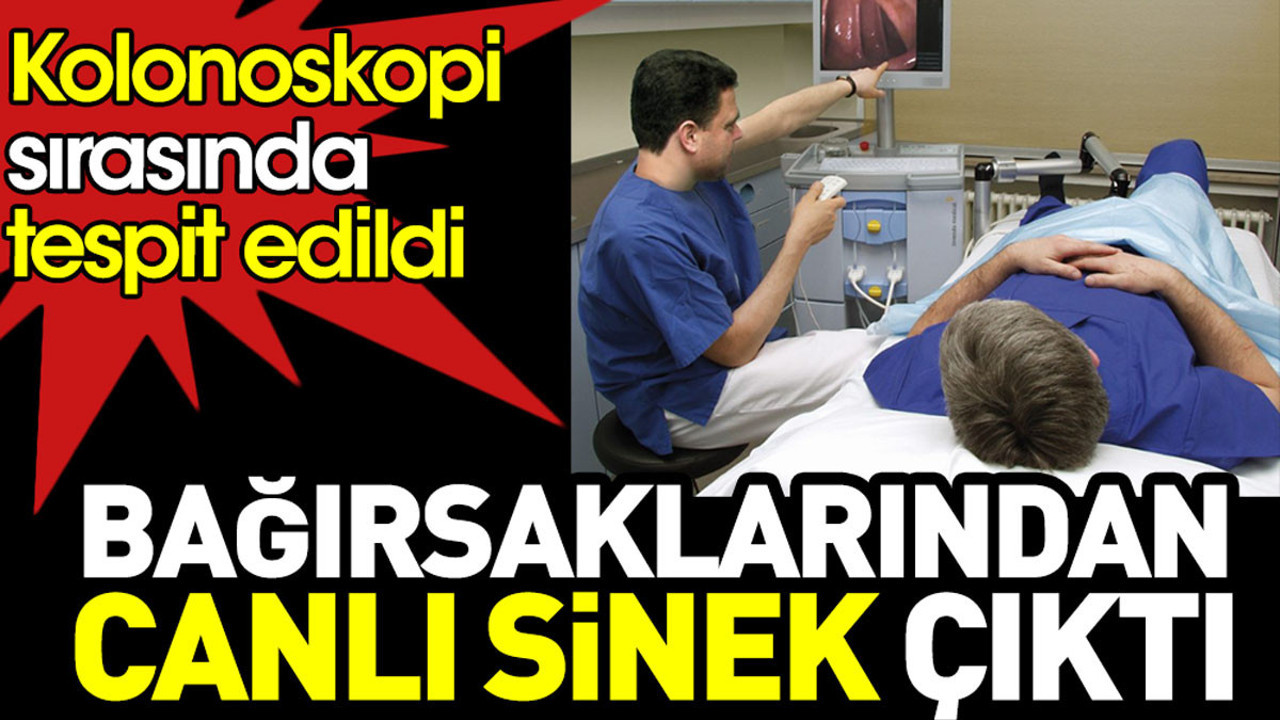 Bağırsaklarından canlı sinek çıktı. Kolonoskopide tespit edildi
