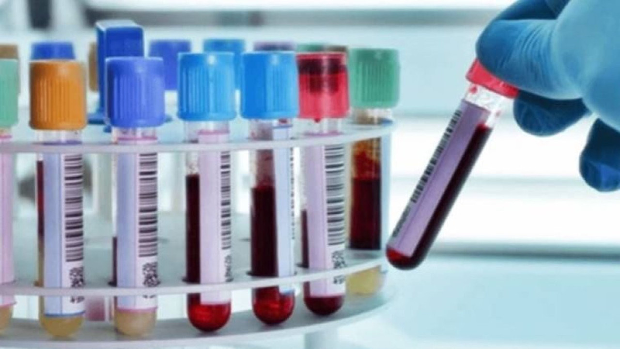 A ve B kan grubu olanlar dikkat