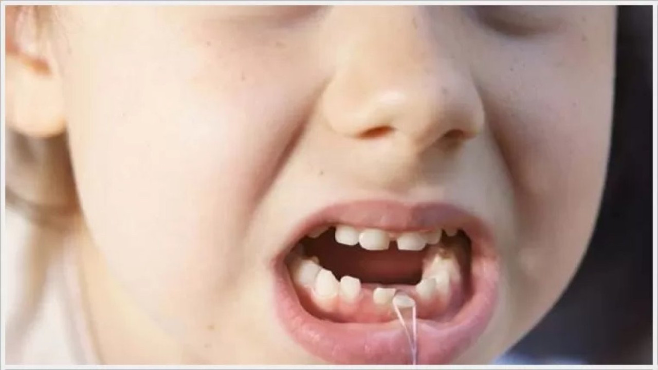 Çocukların çürüyen dişlerini takibe alın