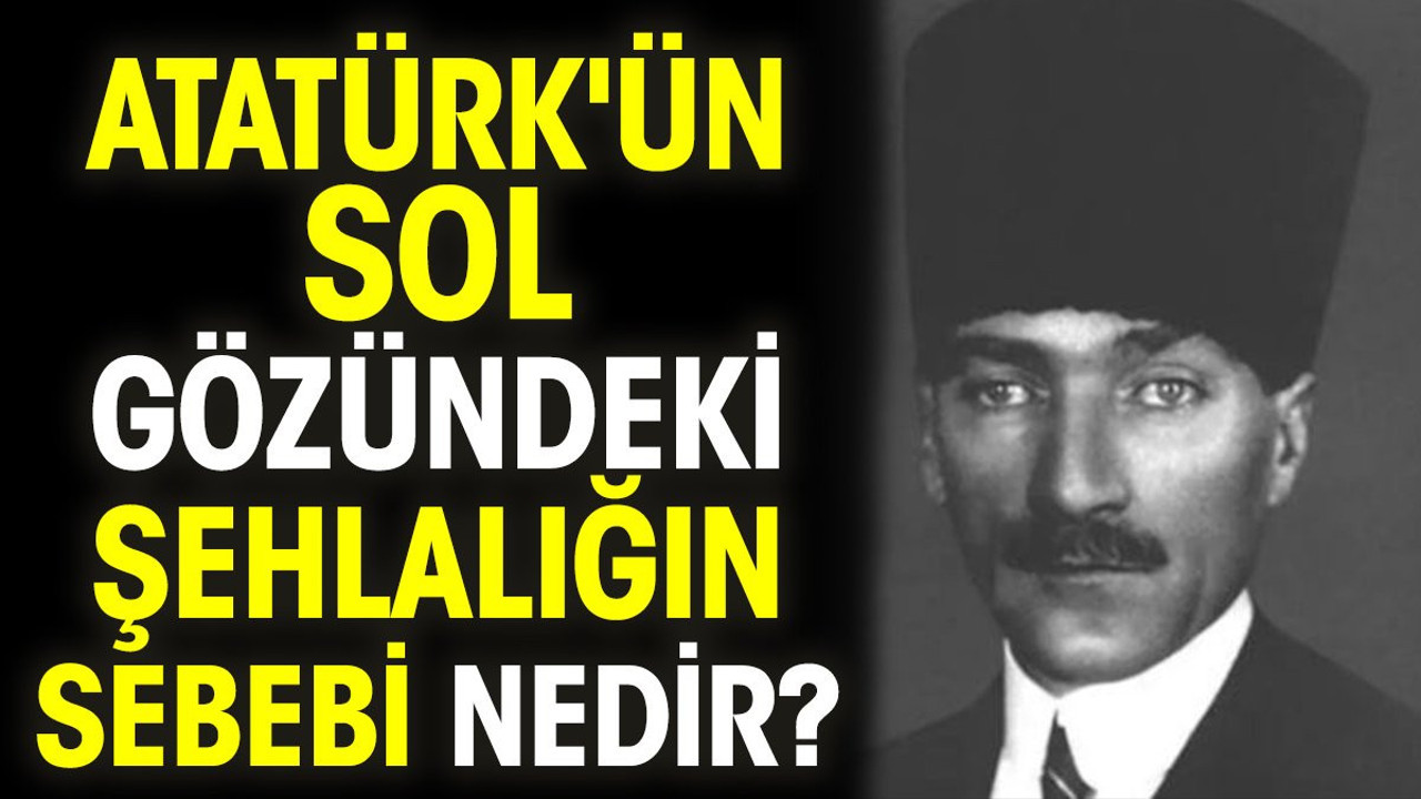 Atatürk'ün sol gözündeki şehlalığın sebebi nedir?