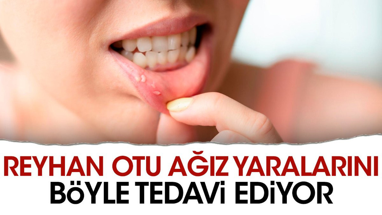Reyhan otu ağız yaralarını böyle tedavi ediyor