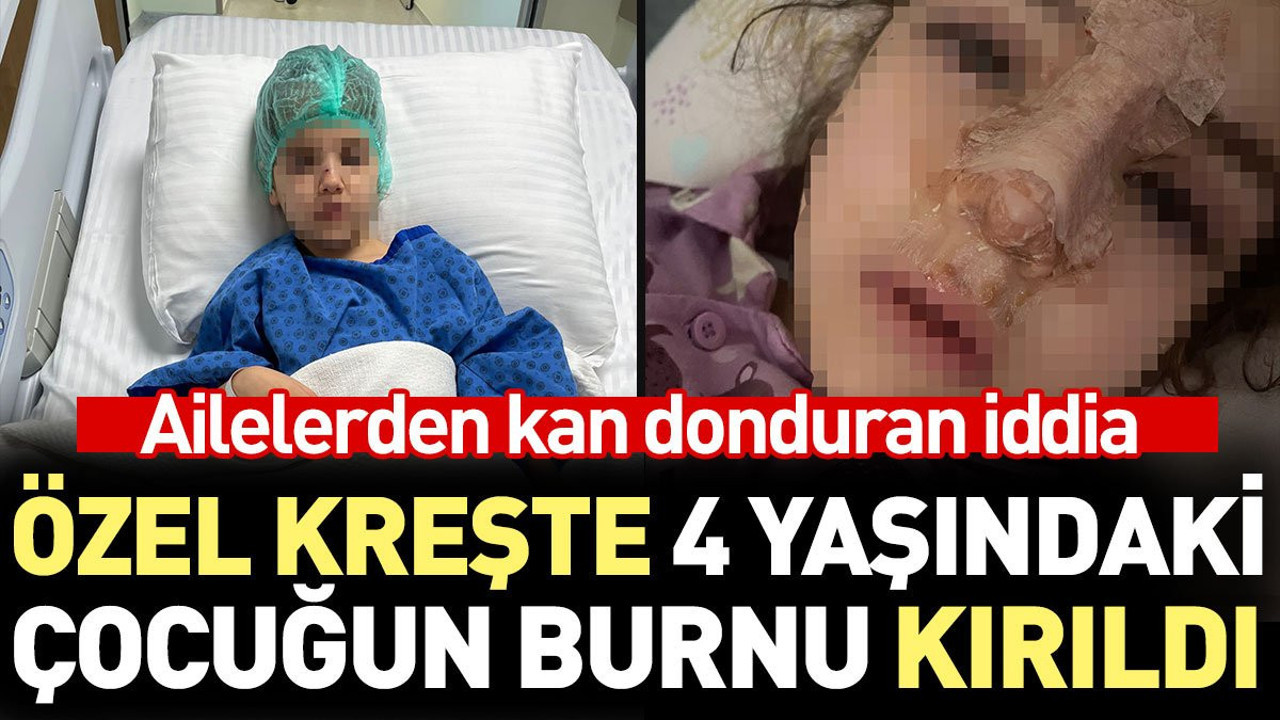 Özel kreşte 4 yaşındaki çocuğun burnu kırıldı. Ailelerden kan donduran iddia