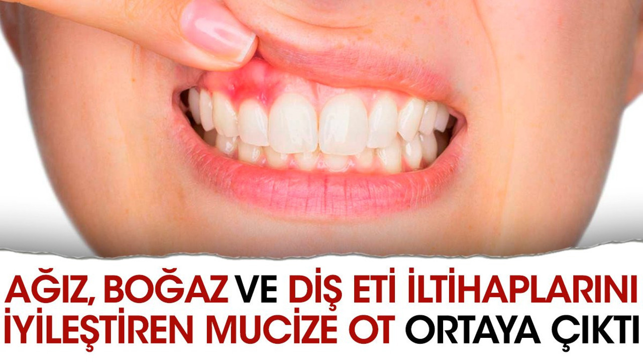 Ağız boğaz ve diş eti iltihaplarını iyileştiren mucize ot ortaya çıktı