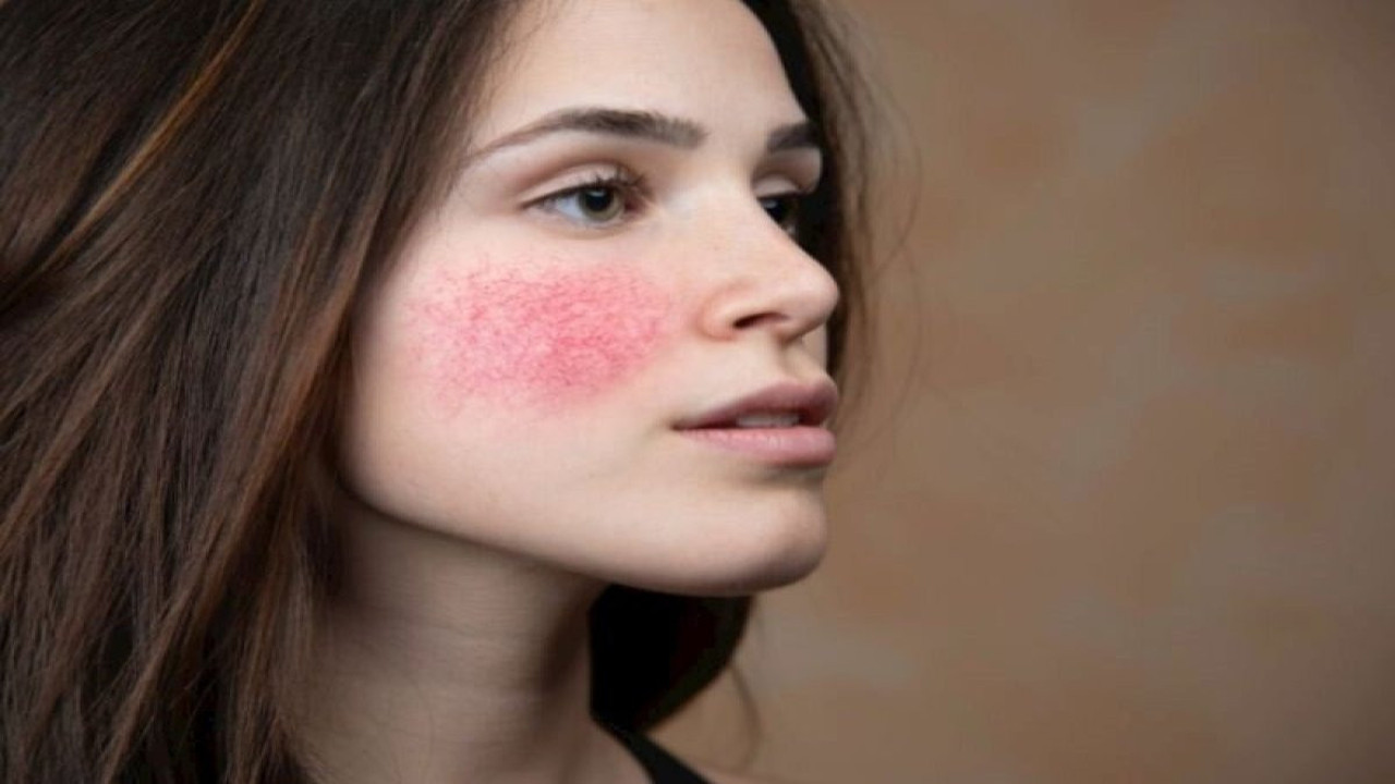 Deri hastalıklarının en önemli nedeni