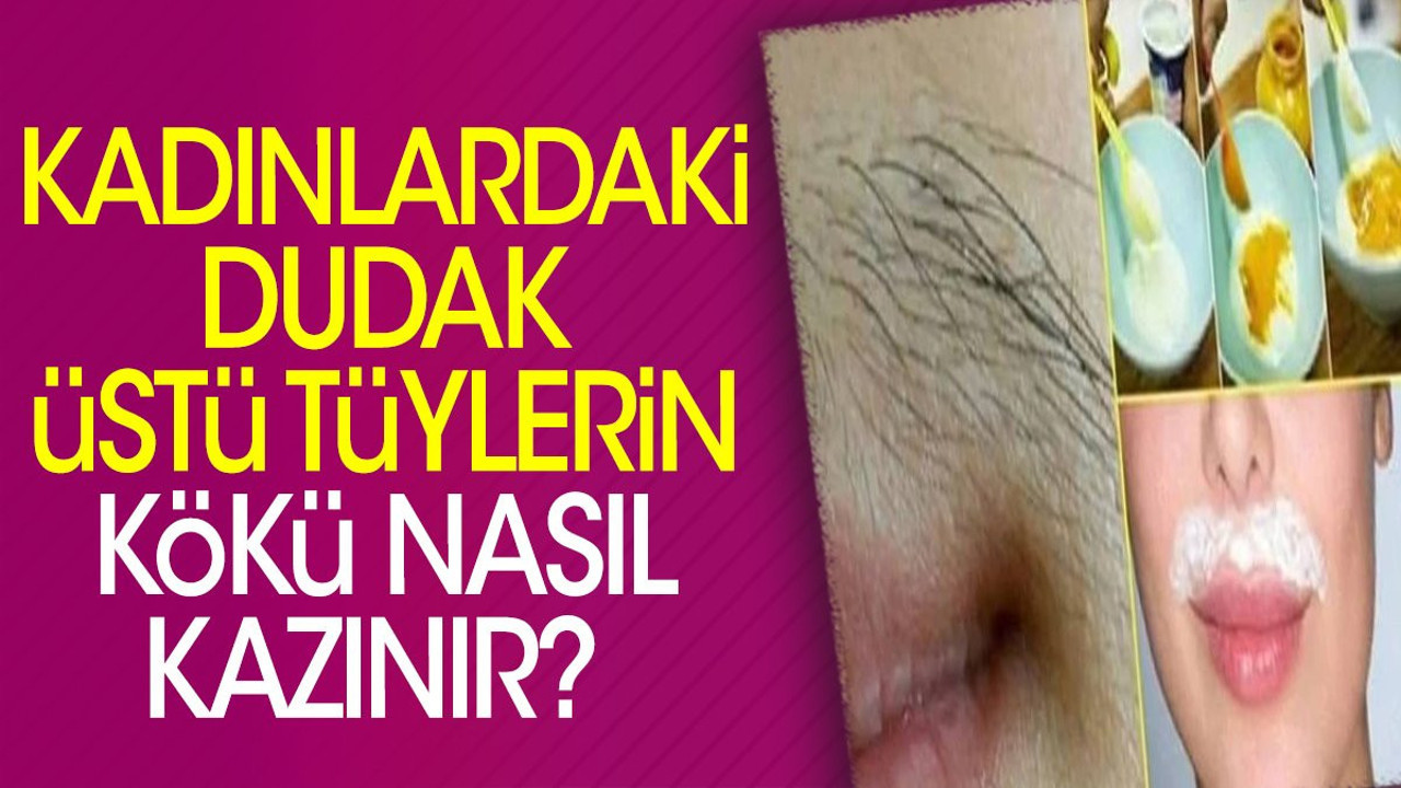 Kadınlardaki dudak üstü tüylerin kökü nasıl kazınır? İşte doğal çözümler…