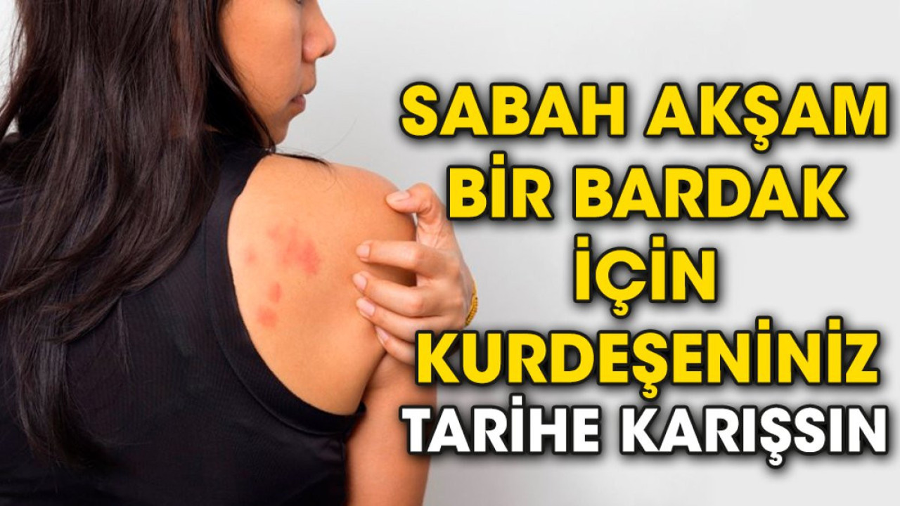 Sabah akşam bir bardak için kurdeşeniniz tarihe karışsın