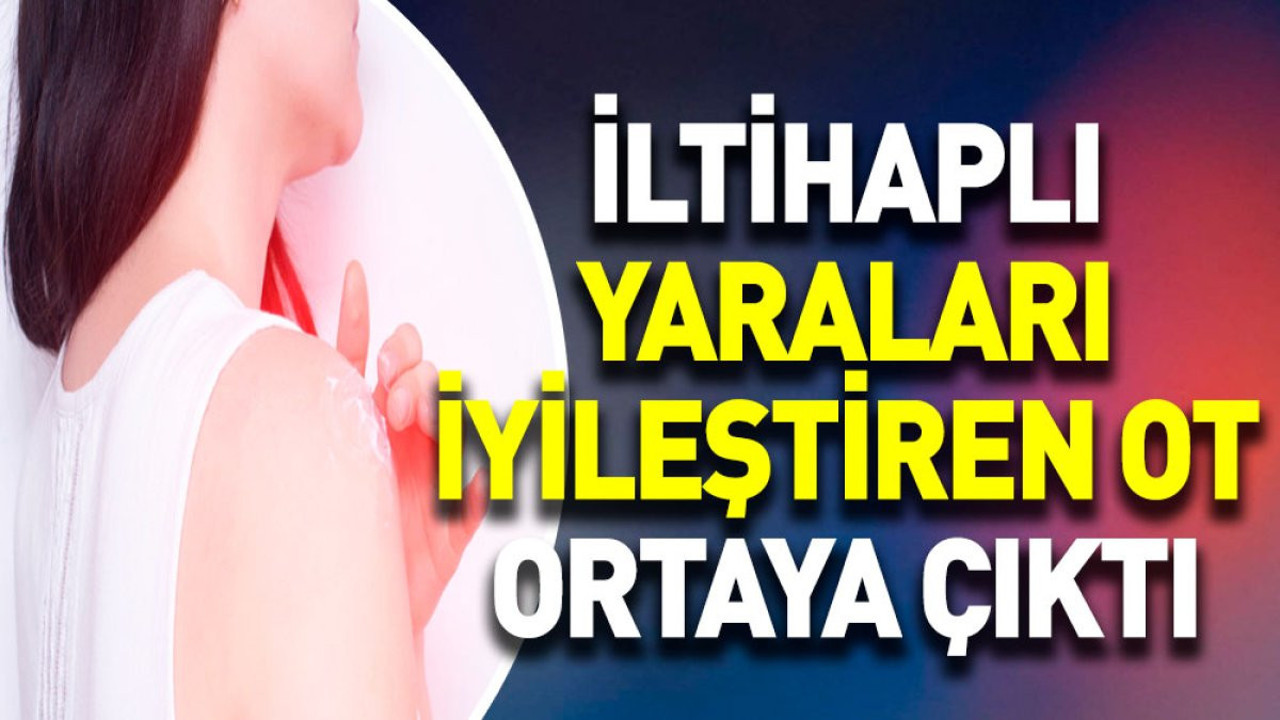 İltihaplı yaraları iyileştiren ot ortaya çıktı