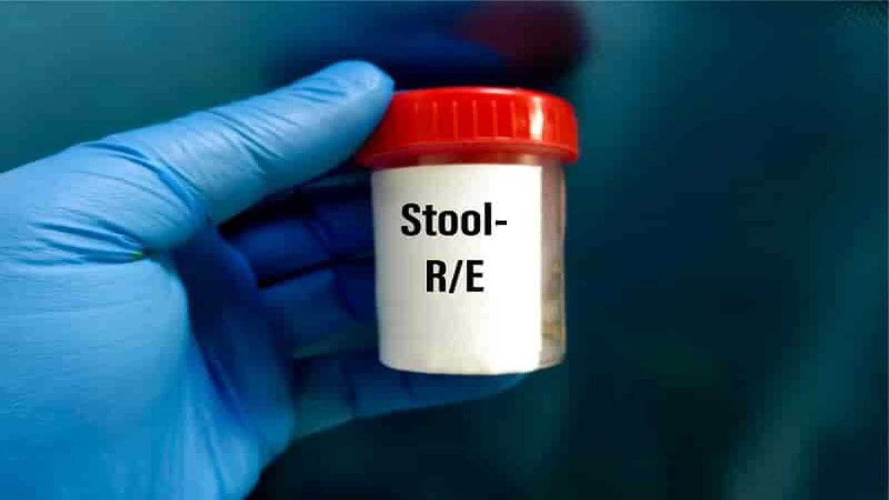 Gizli kan testi sonuçları yanıltabilir mi