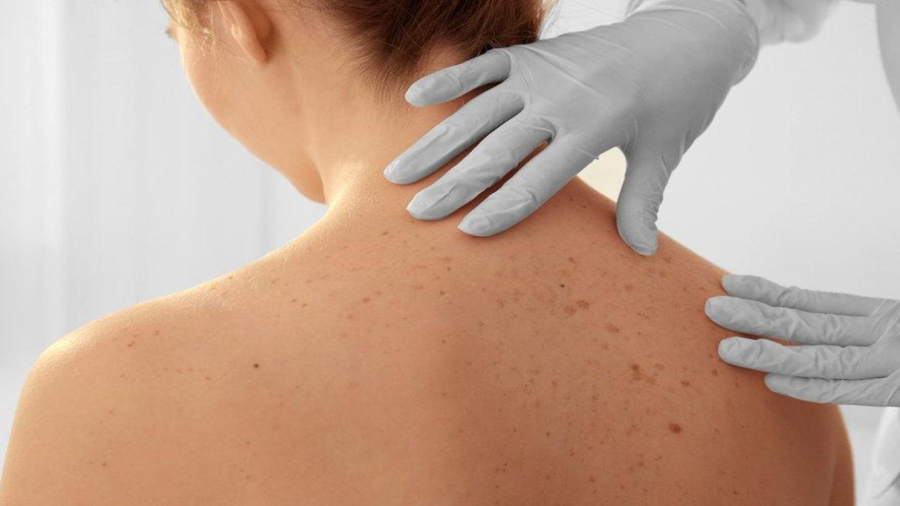 Vücutta oluşan iltihaba savaş açan ot ortaya çıktı