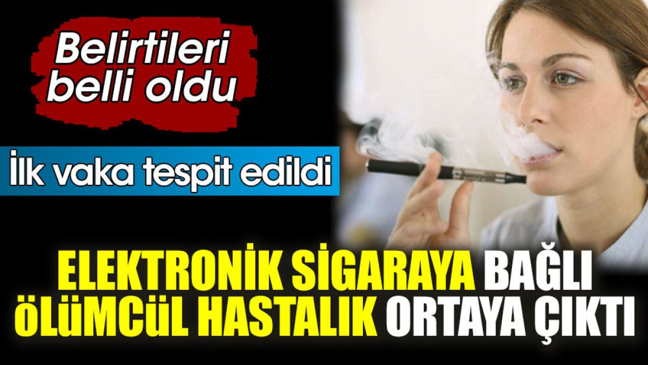 Elektronik sigaraya bağlı ölümcül hastalık ortaya çıktı. Belirtileri belli oldu. İlk vaka tespit edildi